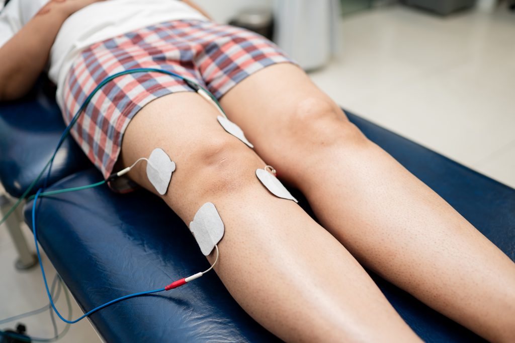 In this picture we can see how use of NMES/FES type of machine based treatment helps in early activation of knee muscles after stroke/paralysis